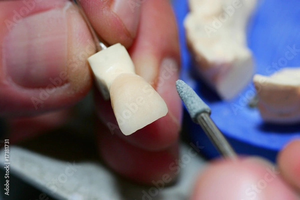 Obraz Laboratorio odontotecnico (4)