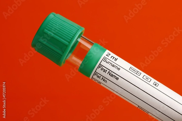 Obraz Test Tube