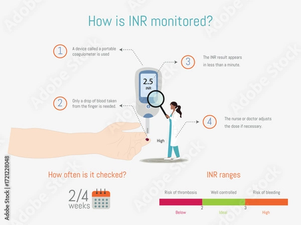 Fototapeta Monitoring international normalized ratio - inr - levels for anticoagulant treatment