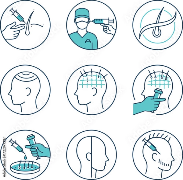 Obraz Hair Restoration and Treatment Vector Line Icons Set: Medical Professionals, Syringes, and Hair Follicle Procedures
