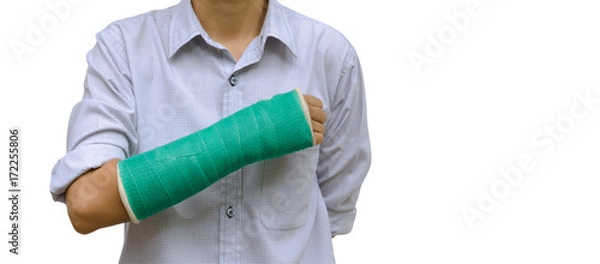 Obraz injury woman broken arm with green cast on arm standing on white background
