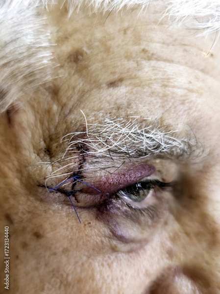 Obraz Older man hit eye