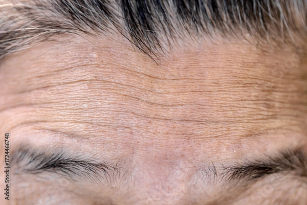 Fototapeta Wrinkles on a man's forehead
