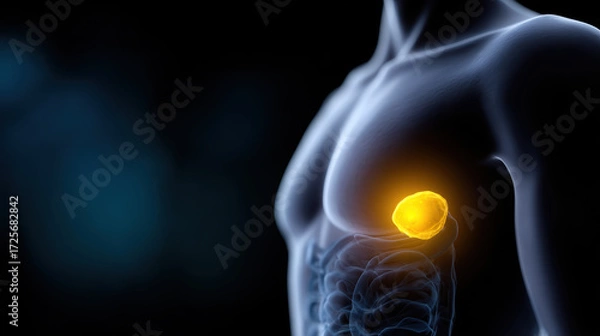 Fototapeta Medical illustration of painful human gallstone disease showing male gallbladder and internal organ anatomy. This condition causes significant discomfort and health problems