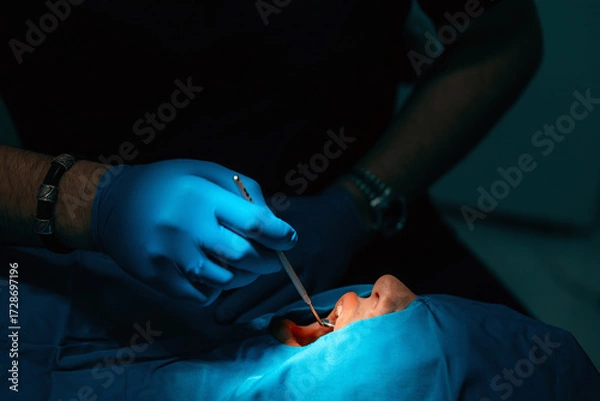 Fototapeta A close-up of a patient during a dental procedure. The mouth is illuminated by a bright blue lamp, while the doctor's blue-gloved hands work with a dental instrument. This emphasizes precision and hyg