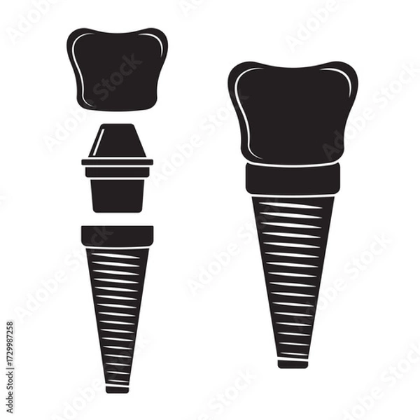 Fototapeta Dental implant, silhouette icon. Screw prosthesis, Illustration of dental implantation,orthodontic dental implantation