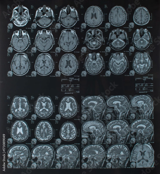 Obraz computed tomography of the human brain and skull