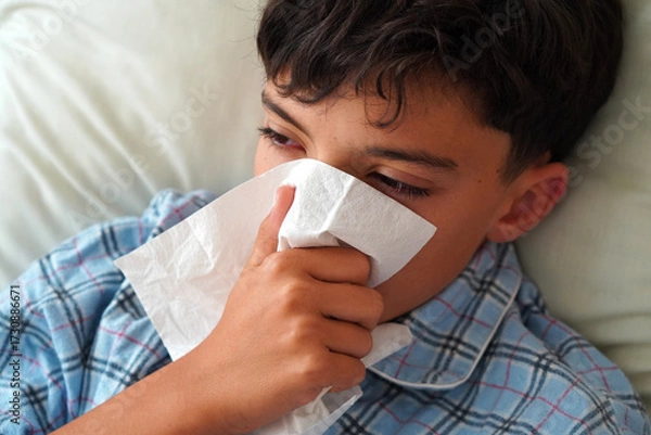 Fototapeta child health and well-being concept. child in pajamas with tissue and red eyes