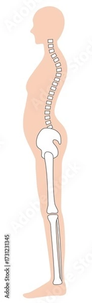 Obraz 反り腰の女性　背骨と骨盤