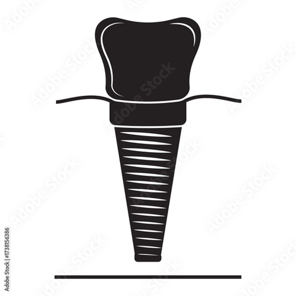 Fototapeta Dental implant, silhouette icon. Screw prosthesis, Illustration of dental implantation,orthodontic dental implantation
