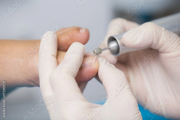 Obraz Pielęgnacja stóp