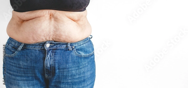 Fototapeta Close up of overweight woman belly with folds of skin in jeans, banner on white background with copy space for text, concept of health, aging and body care
