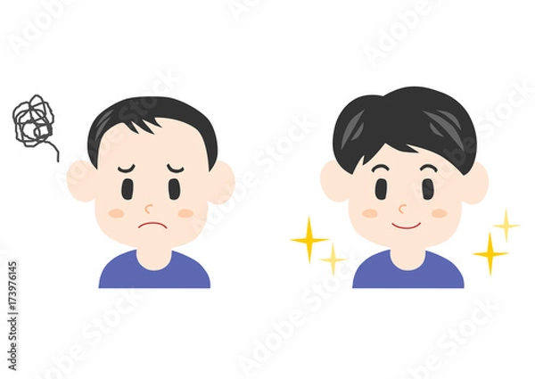 Fototapeta 薄毛に悩む男性のイラスト