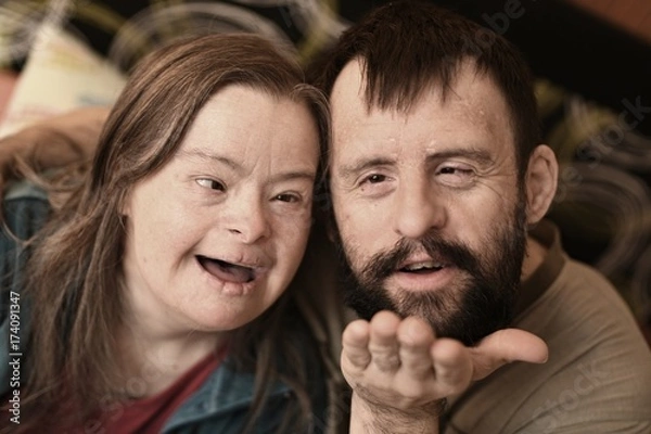 Obraz couple trisomique