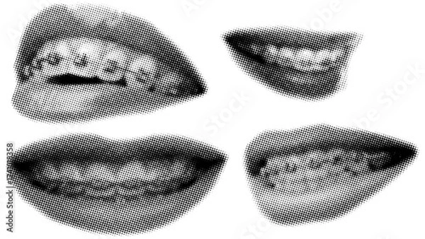 Fototapeta Human teeth with braces in retro halftone style,trendy collage elements