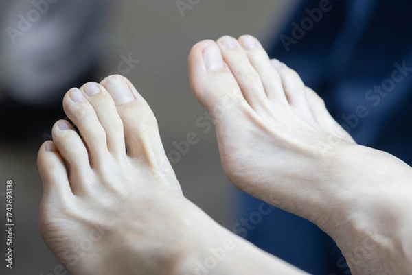 Fototapeta Close-up of Female Feet Resting on a Soft Surface. Pedicure Preparation or Relaxation
