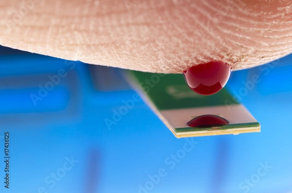 Obraz blood  sugar test