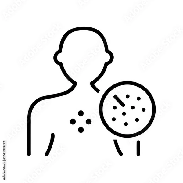 Fototapeta Outline of person with skin allergy testing and spots on chest  