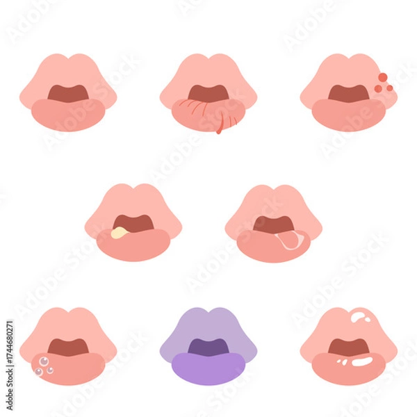 Obraz 様々な症状の唇セット