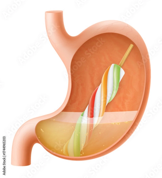 Fototapeta Human Stomach with popsicle ice cream. The stomach digests ice cream. A stomach with Ice cream frozen juice on stick. Delicious sweet food. Realistic 3d Vector illustration. Food digestion process.