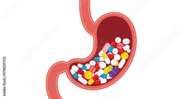 Fototapeta A graphic representation of a stomach filled with numerous colorful pills and capsules.