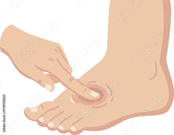 Obraz Checking edema 