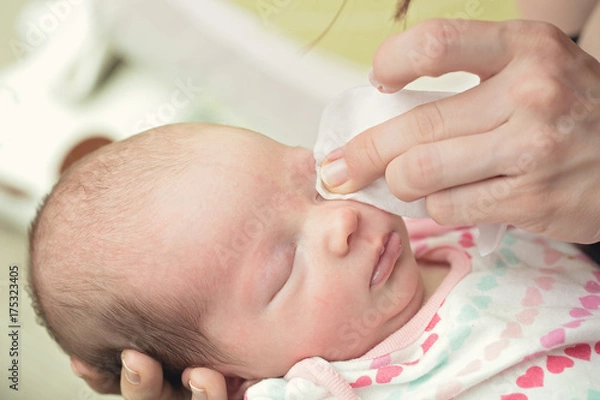 Obraz Mother cleaning eyes of a newborn baby with physiological solution on a cotton strip; baby's stork bites visible on eyelid and forehead