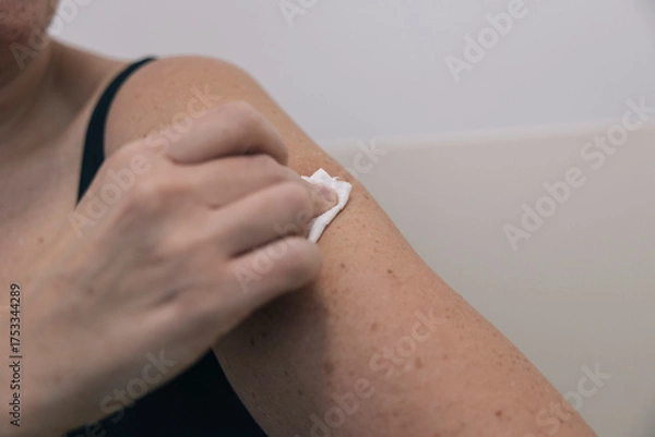 Fototapeta Unrecognizable woman cleaning her arm with a disinfectant wipe after receiving a vaccine injection