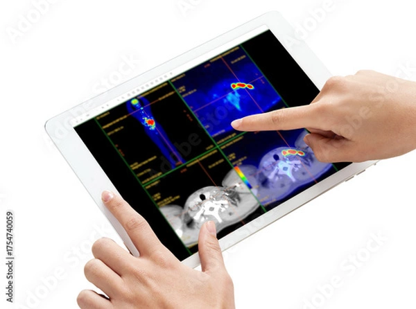Fototapeta Hand interacting with tablet displaying PET/CT scans. Multiview diagnostic imaging highlights abnormal metabolic activity. Ideal for medical, oncology, and tech-related visuals.