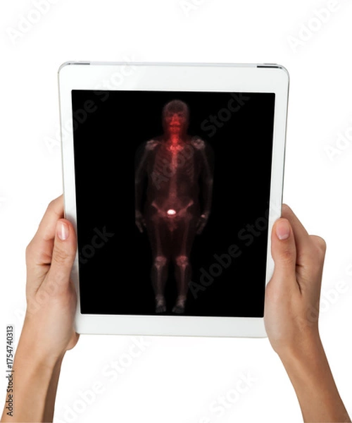 Fototapeta Hand interacting with tablet displaying PET/CT scans. Multiview diagnostic imaging highlights abnormal metabolic activity. Ideal for medical, oncology, and tech-related visuals.