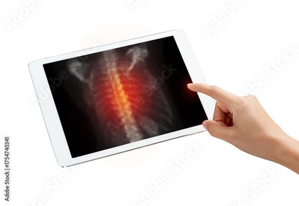 Fototapeta Hand interacting with tablet displaying PET/CT scans. Multiview diagnostic imaging highlights abnormal metabolic activity. Ideal for medical, oncology, and tech-related visuals.