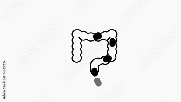 Obraz Cartoon illustration of human intestines with dark spots on a white background anatomy digestive system