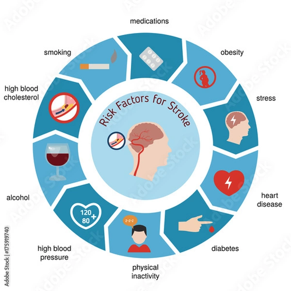 Obraz Infographics for stroke