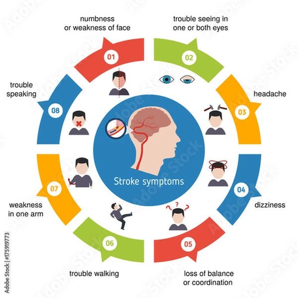 Fototapeta Infographics for stroke