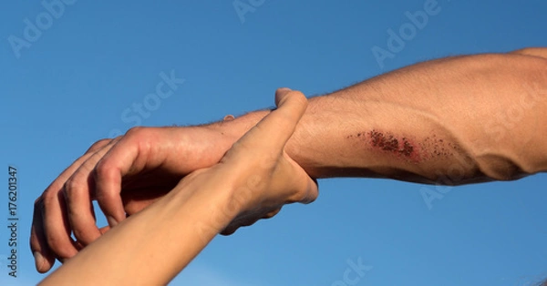 Obraz Two arms on blue sky