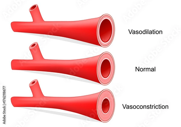 Fototapeta Vasoconstriction, Vasodilation, and normal artery. Comparison of normal, constricted, and dilated blood vessels