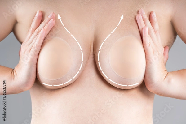 Obraz Breast augmentation, saggy breast before aesthetic lifting procedure, reduction mammoplasty, plastic surgery, healthcare and medicine concept on gray background