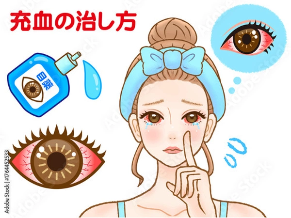 Obraz ドライアイで充血して目薬をさす大人女性のイラスト素材