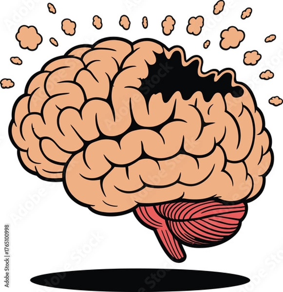 Obraz A conceptual cartoon illustration of cognitive decline and brain fog, symbolizing memory loss and dementia as dust vector illustration