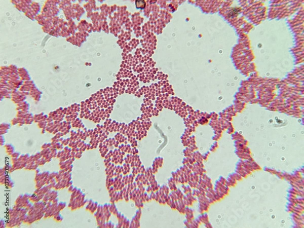 Fototapeta Microscopic View of Purple Cocci Bacteria Clustered in Grapelike Formation