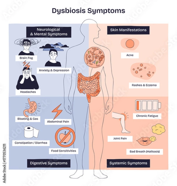 Obraz Dysbiosis symptoms mapped, gut microbiome imbalance linking digestive, skin, and mental signs, key visuals include intestines, human silhouette, and symptom icons. Doodle style diagram