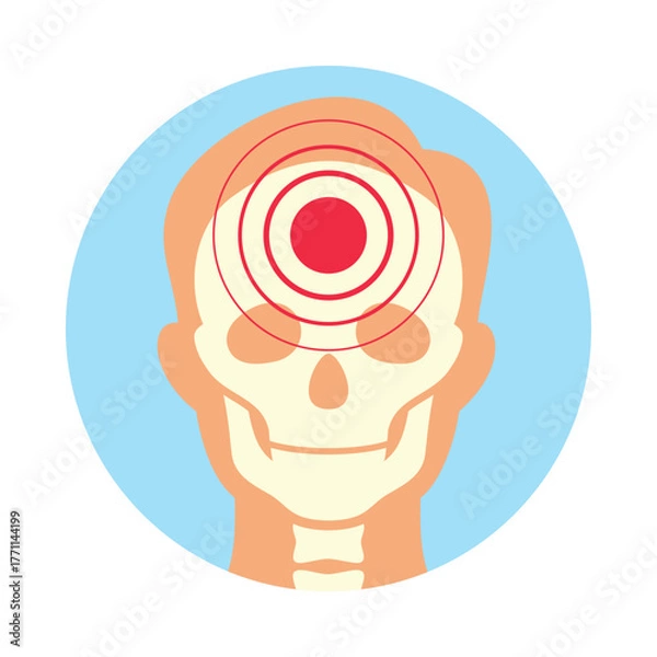 Fototapeta An icon depicting a skull with a headache. The red concentric circles on the forehead symbolize pain.