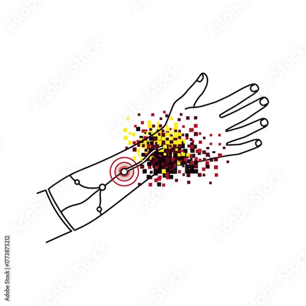 Obraz An abstract illustration depicting pain, inflammation, or a medical condition on a human wrist, showing nerve pathways and a burst of colored particles.