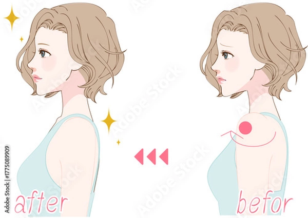 Obraz 巻き肩を整える女性の横顔ビフォーアフター