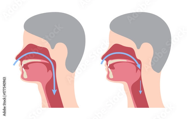 Obraz infografika / wektor chrapania