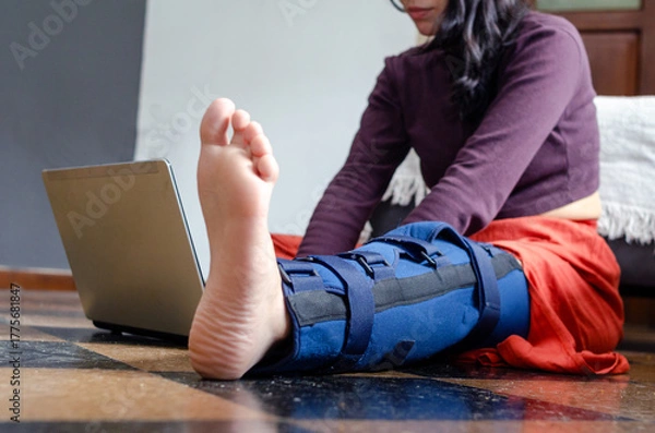 Fototapeta Young woman with a broken leg working from home with a laptop.