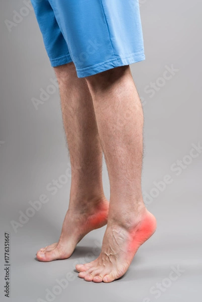 Obraz Man standing on tiptoes with foot pain, medical concept of male heel and sole discomfort