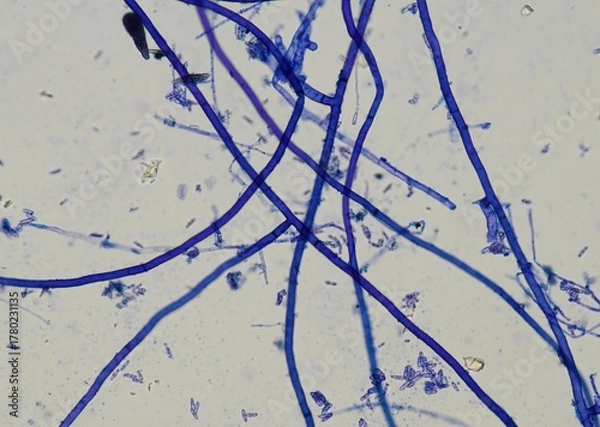 Fototapeta soil microorganisms under a microscope including amoeba, flagellates, nematodes, fungi, bacteria	

