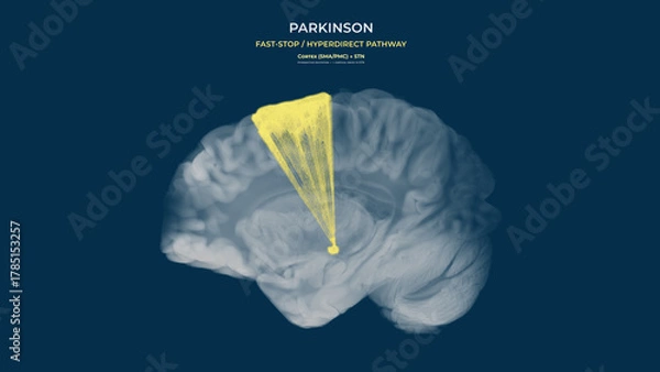 Obraz Parkinson Dopamine Loss Hyperdirect Pathway Overactivation Sagittal View