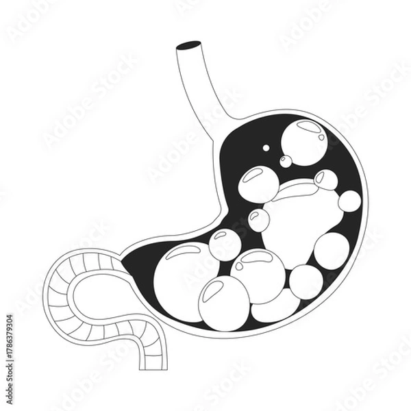 Obraz Gassy and bloated stomach with gas bubbles outline illustration. Digestive health. Indigestion symptom. Human organ cross-section 2D line object isolated on white. Monochrome vector ink linear image